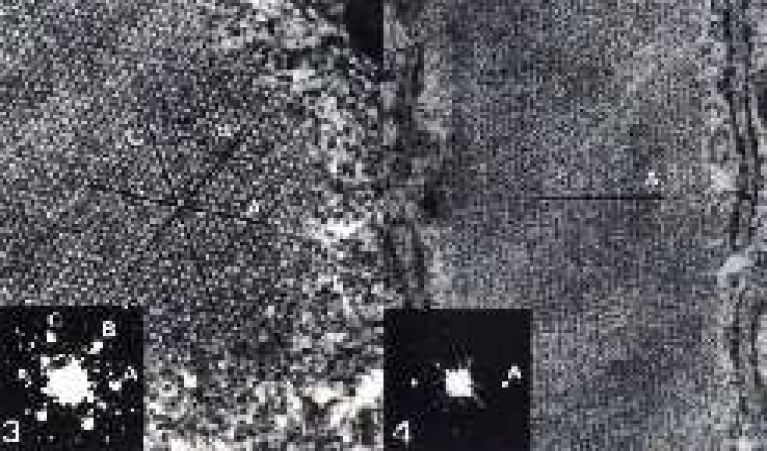 Virus